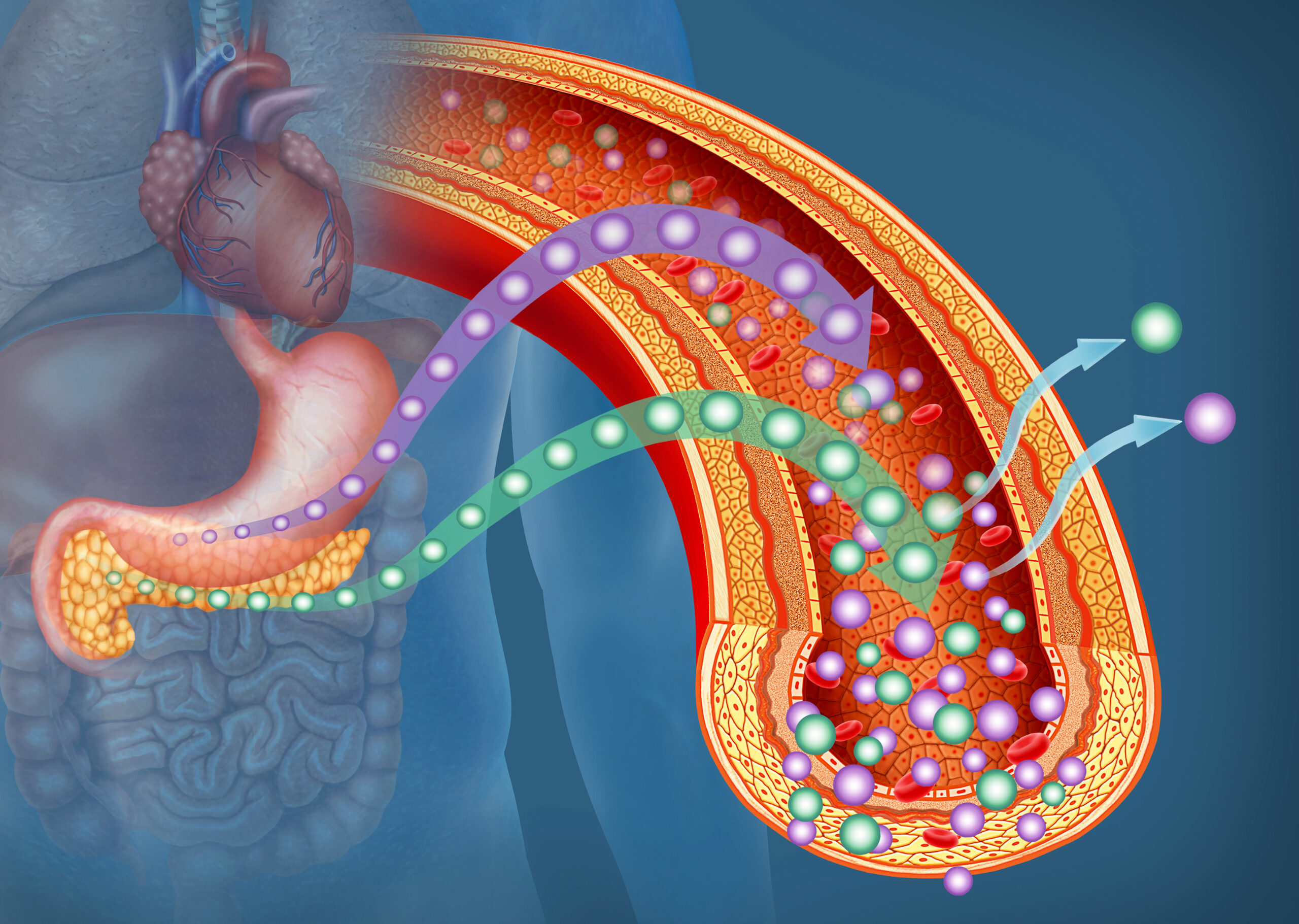 Vector Image of Hyperglycemia | Healthier Me Today
