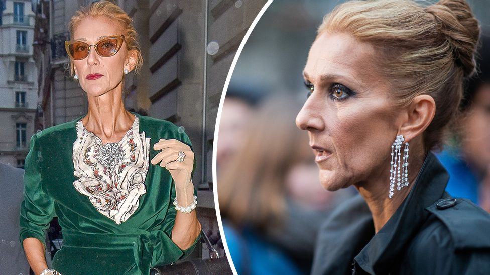 Celine Dion Health | Healthier Me Today