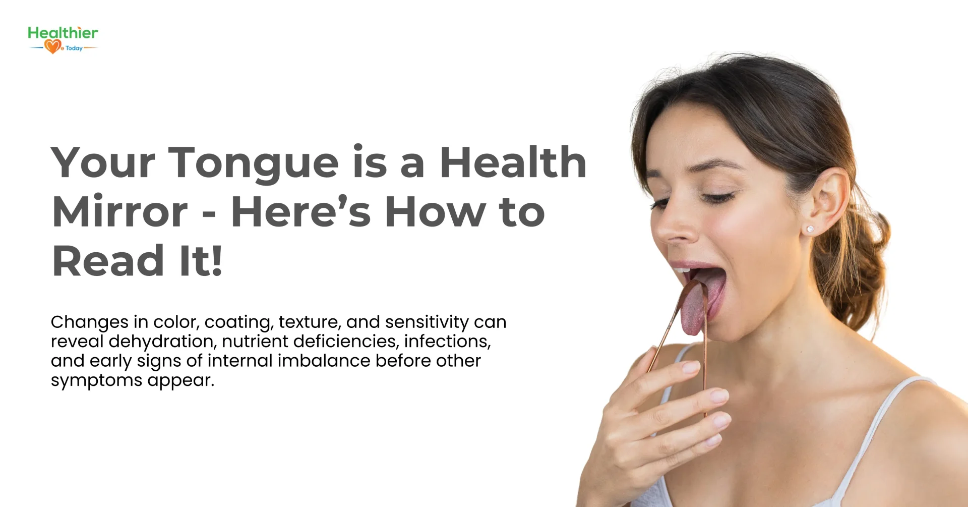 Tongue Health Chart