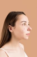 side profile of a woman, dark hair, woman has acne, wearing white top, peach wall // Healthier Me Today