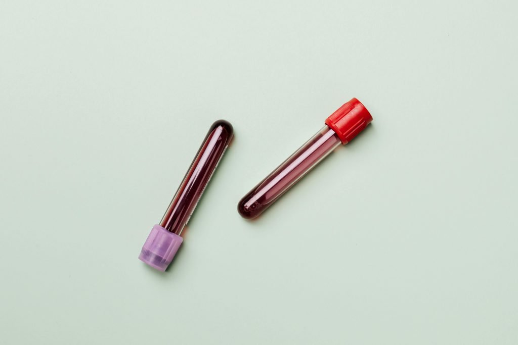 2 Blood Samples, white background // Healthier Me Today