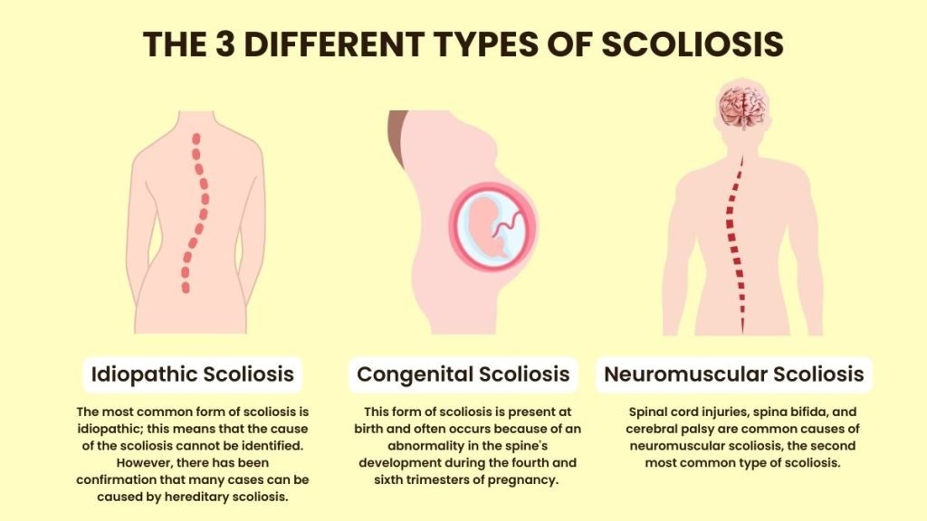 Types of Scoliosis