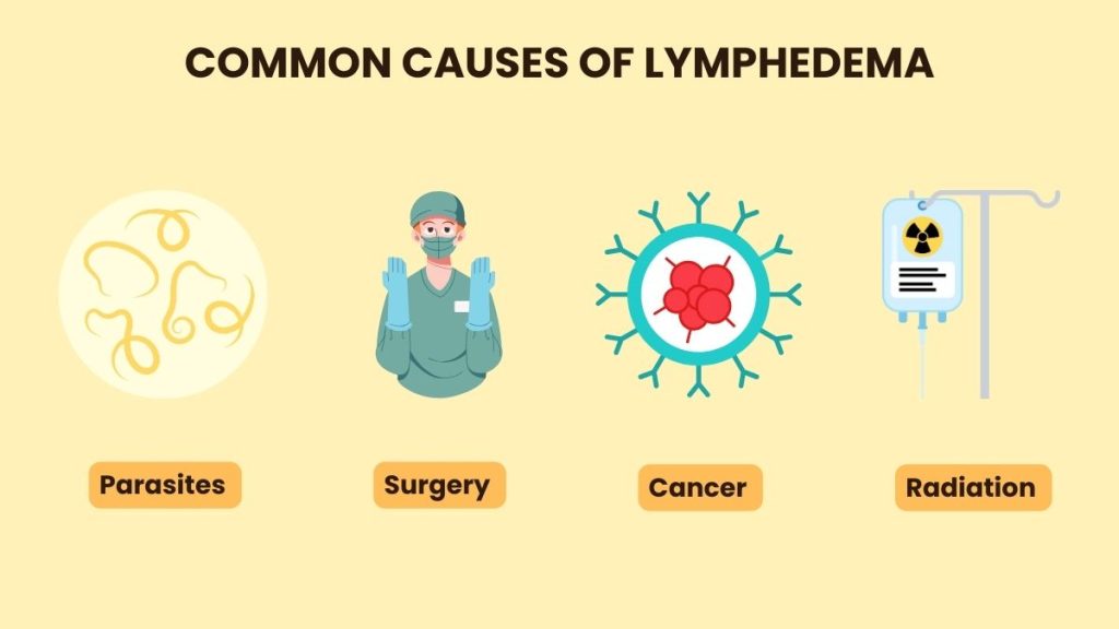 what causes lymphedema