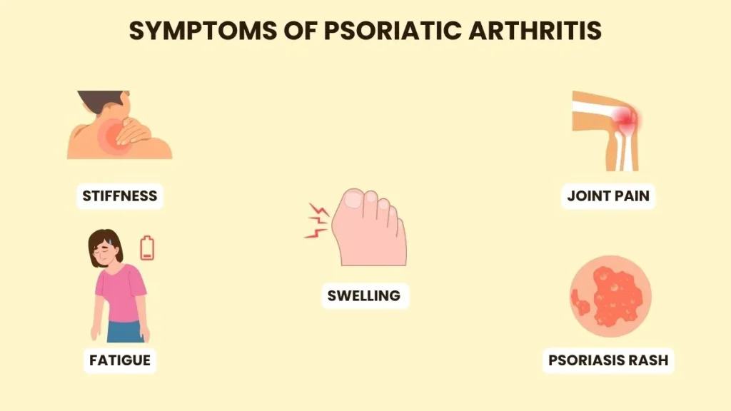 psoriatic arthritis symptoms