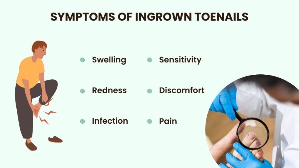 ingrown toenail symptoms