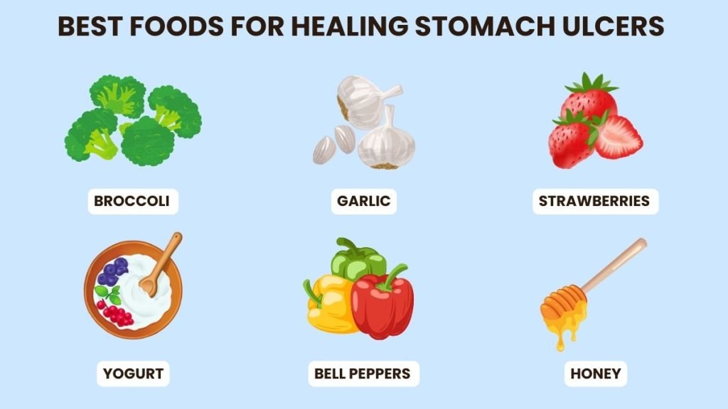 foods to eat with stomach ulcer