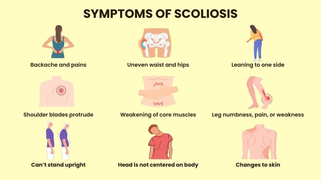 scoliosis symptoms