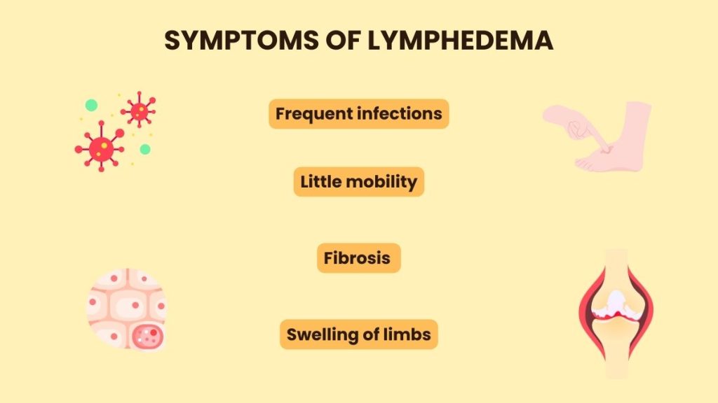 lymphedema symptoms