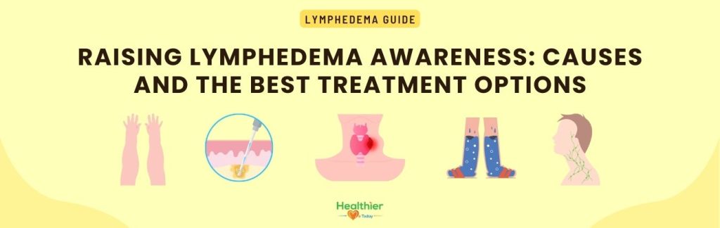 lymphedema