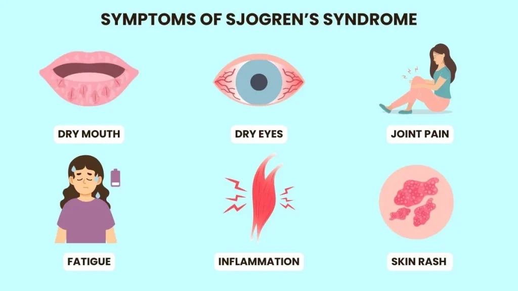 symptoms of sjogren's syndrome