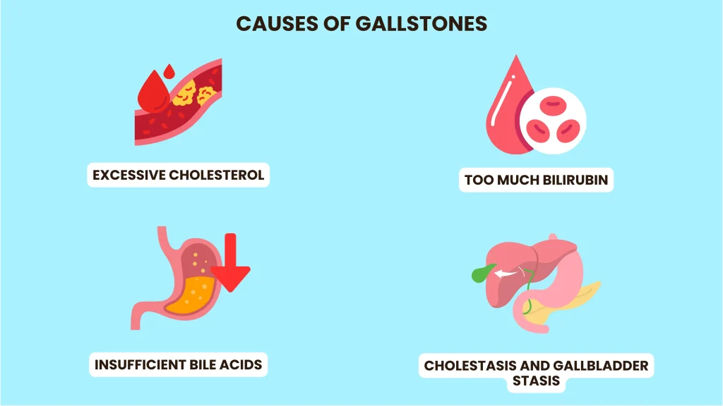 what causes gallstones