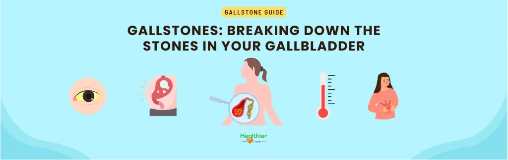 Gallstone
