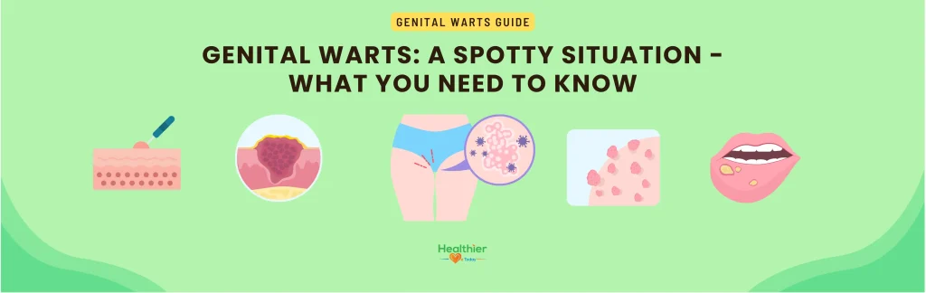 Genital Warts