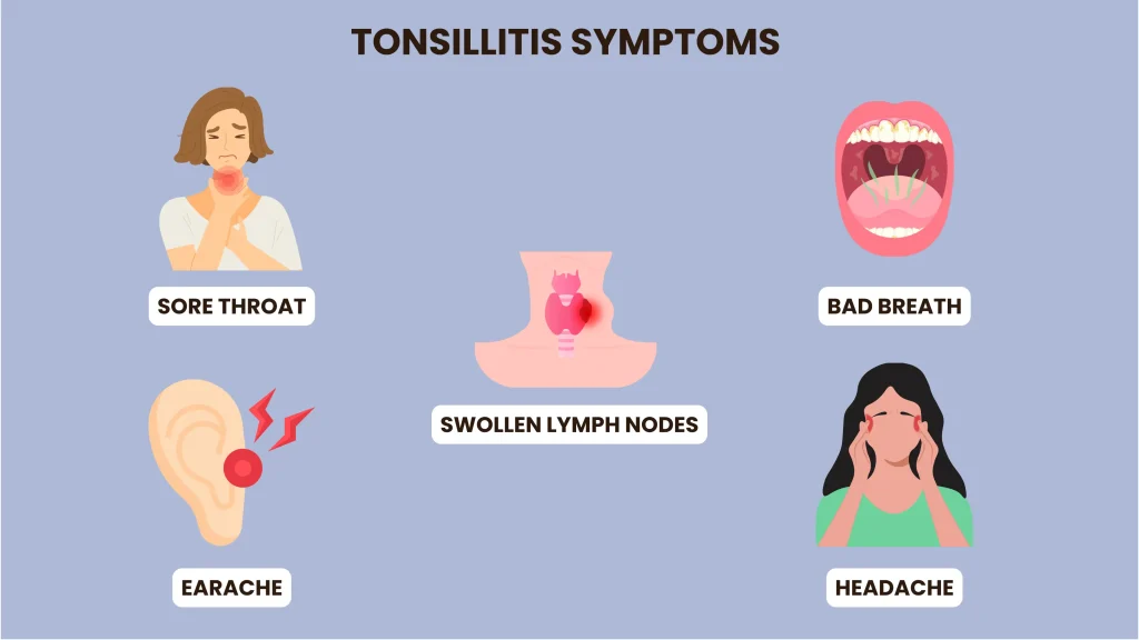 tonsillitis symptoms