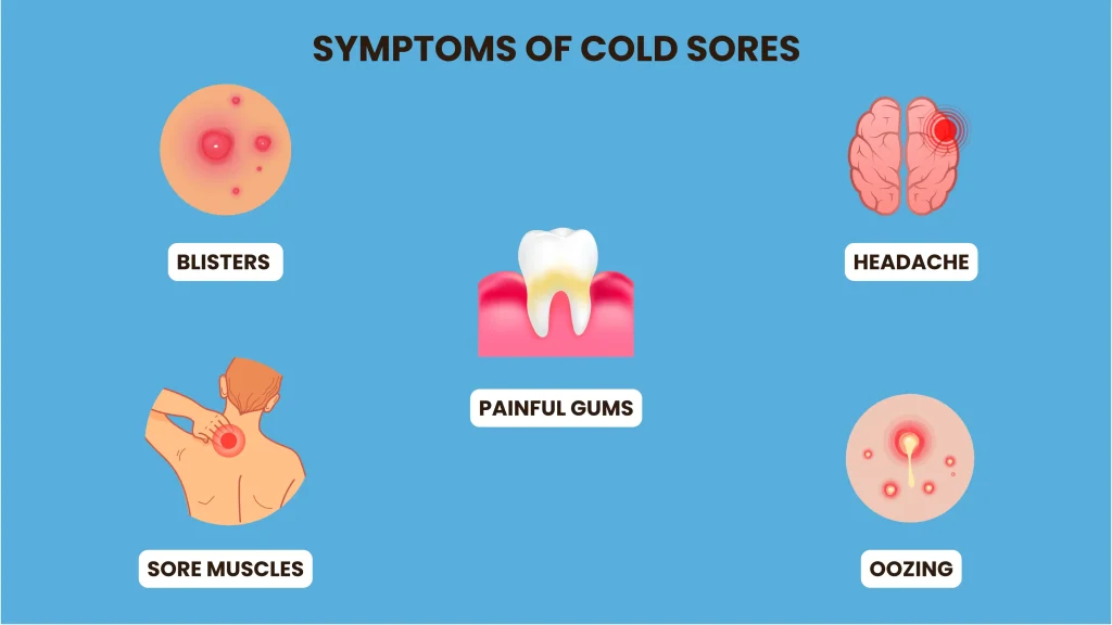 cold sore symptoms