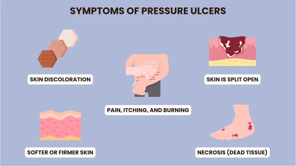 Symptoms of Pressure Ulcers Symptoms of Pressure Ulcers