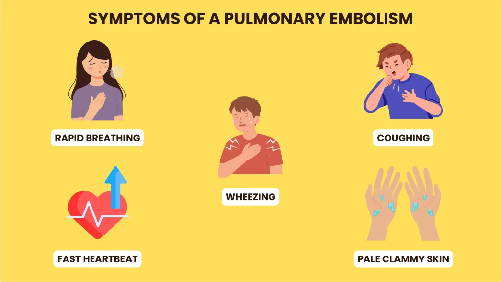 Symptoms Of A Pulmonary Embolism