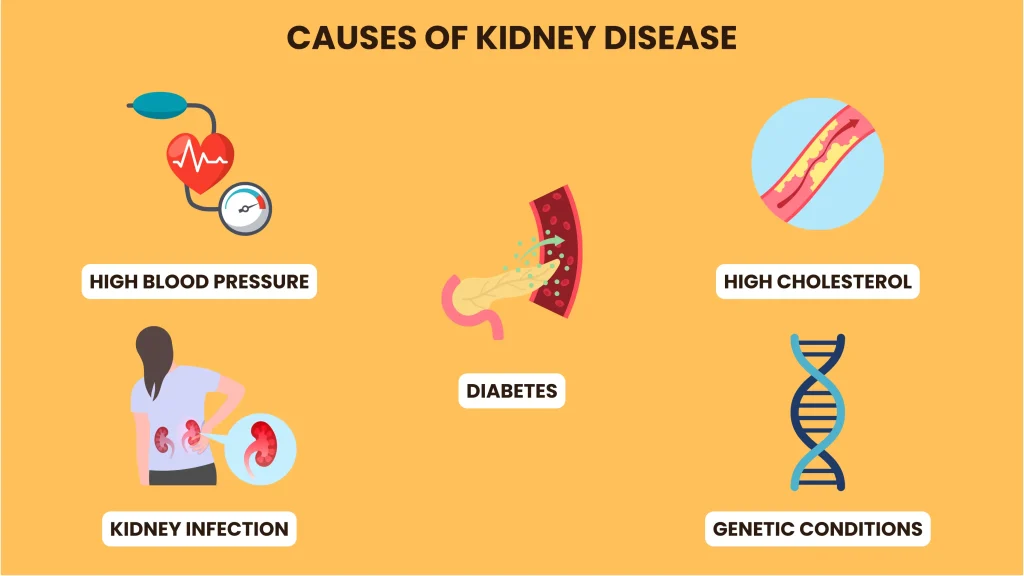 kidney diseases causes