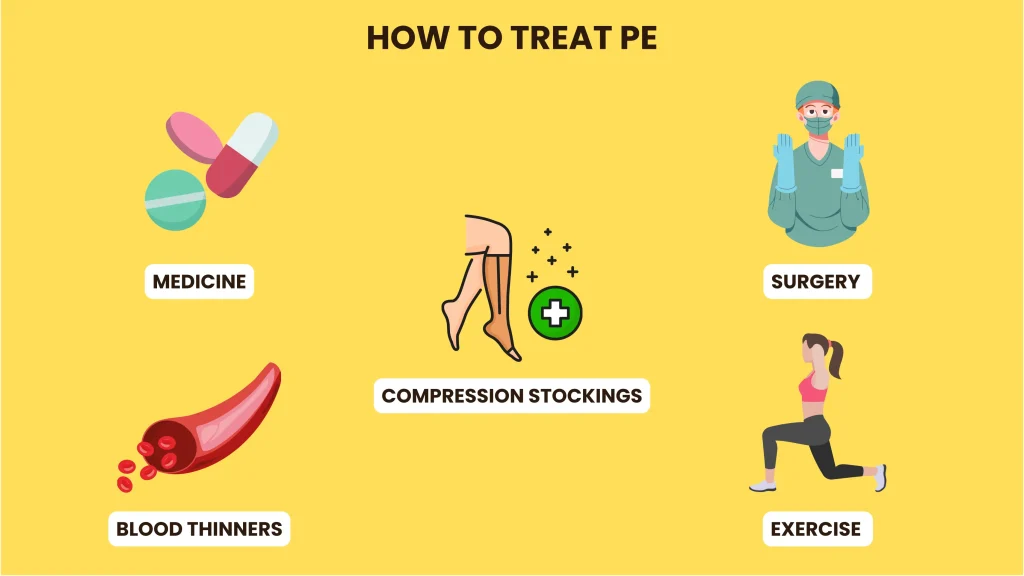 How to Treat PE