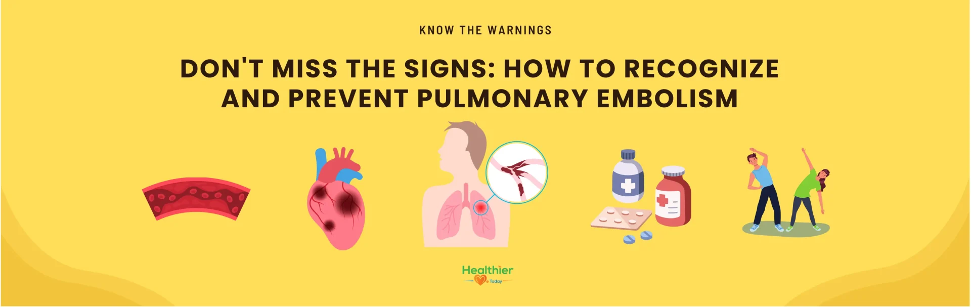 Prevent Pulmonary Embolism