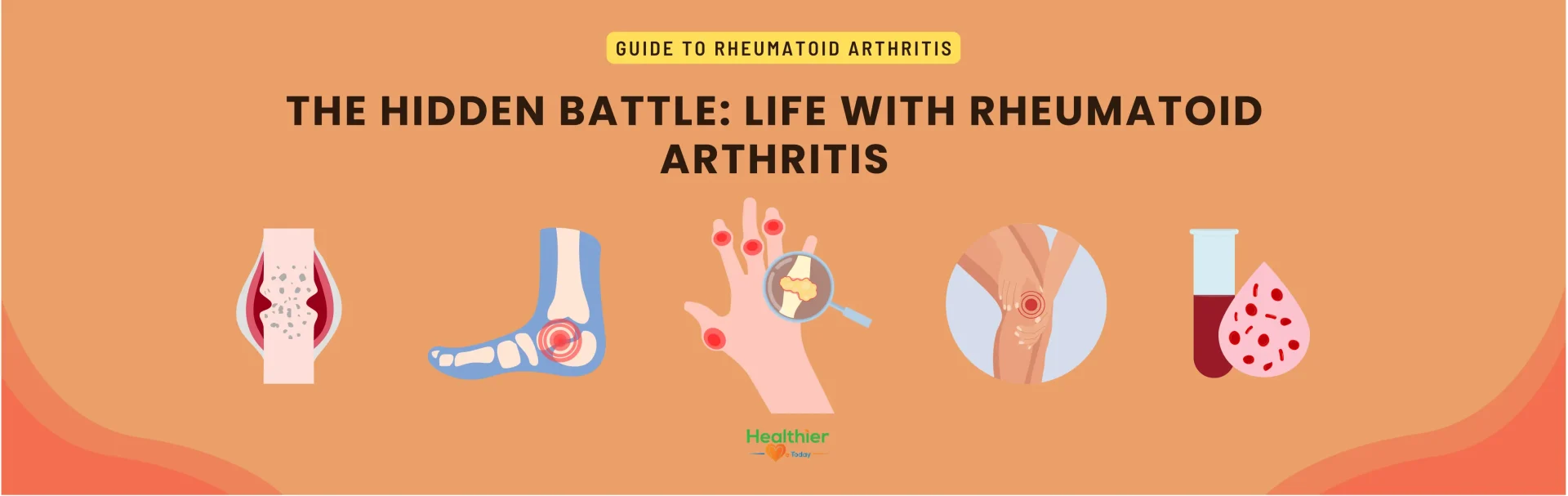 Rheumatoid Arthritis