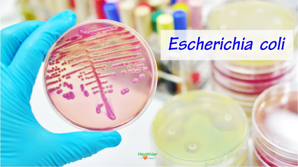 E. coli ground beef
