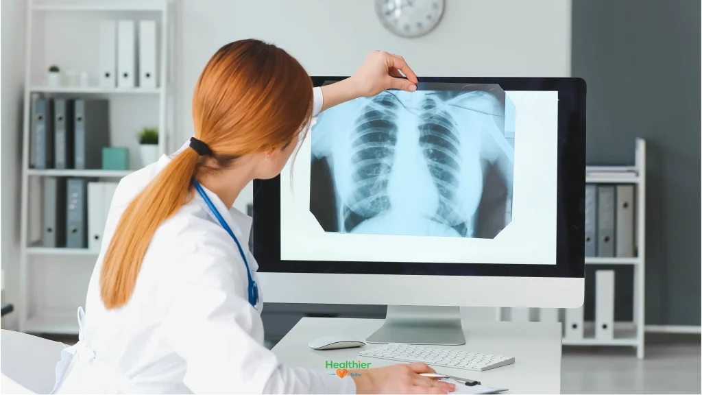 lung cancer diagnoses