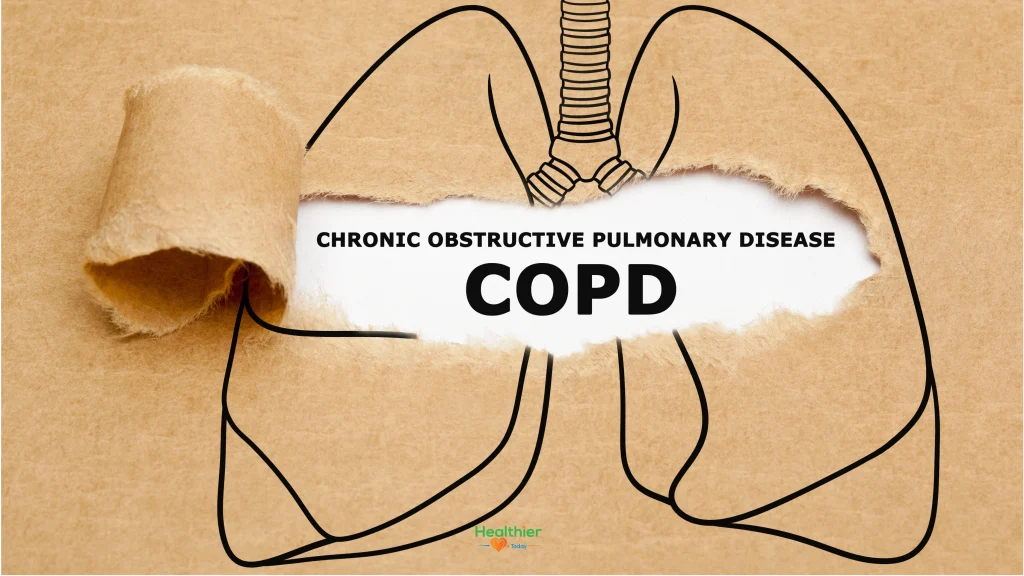 Chronic Obstructive Pulmonary Disease