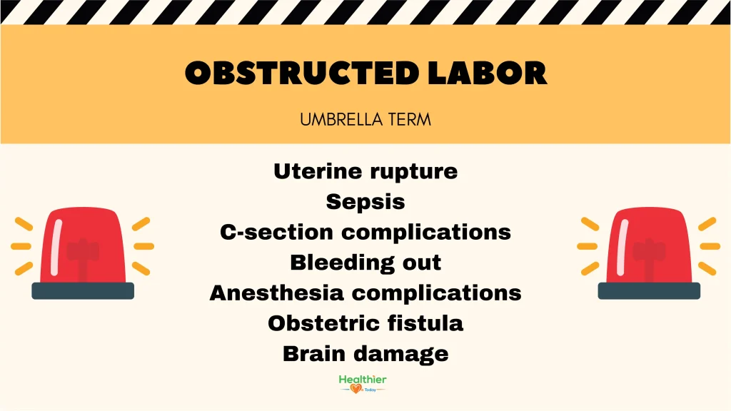Obstructed labor