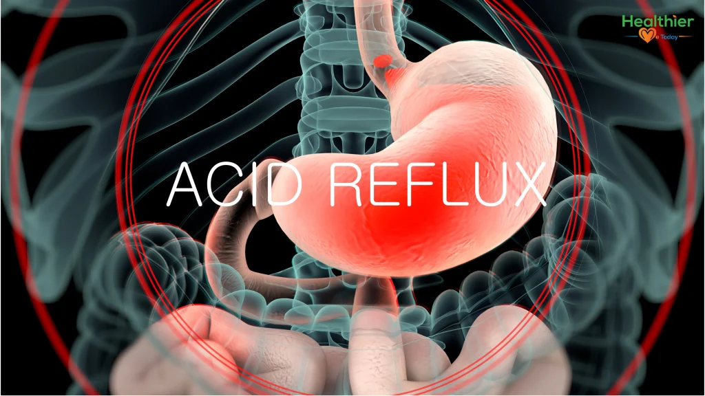 What causes heartburn
