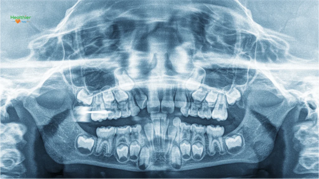 children's dental health