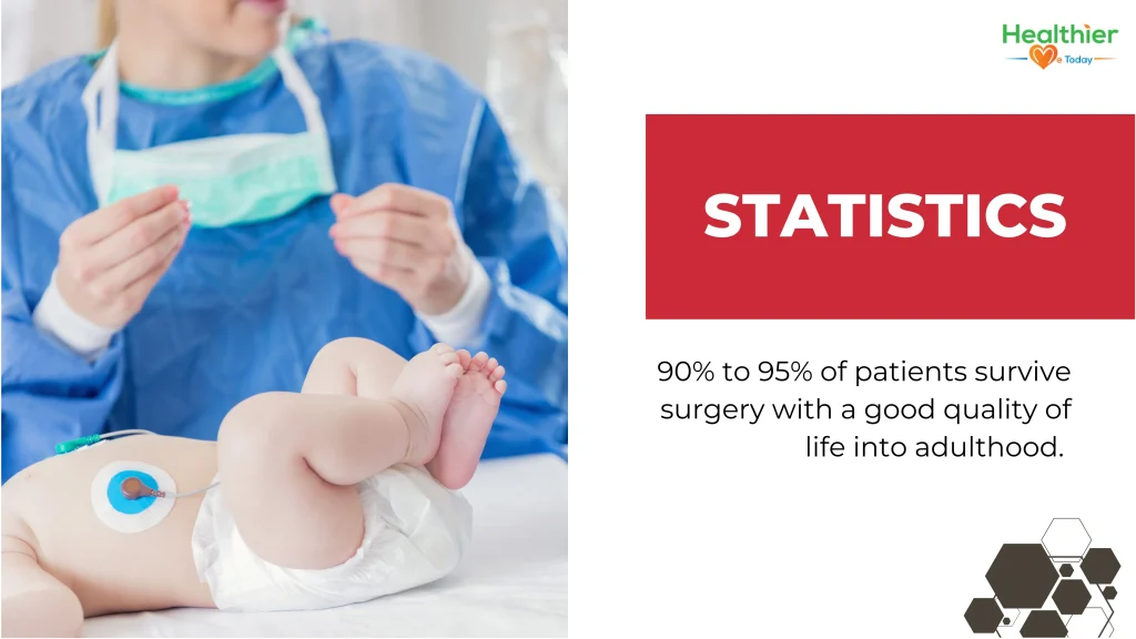 when should tof child get surgery