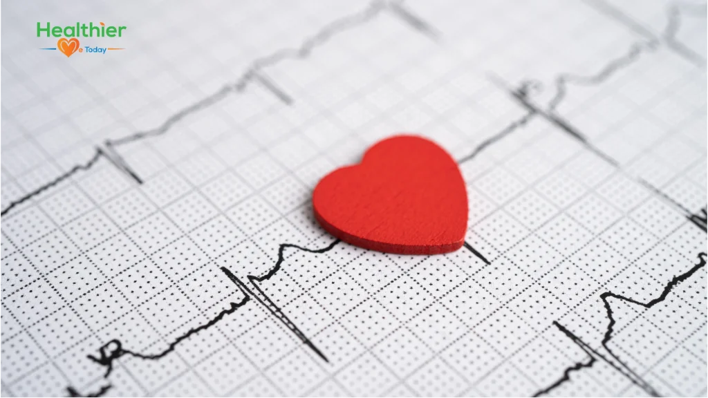 Heart arrhythmia