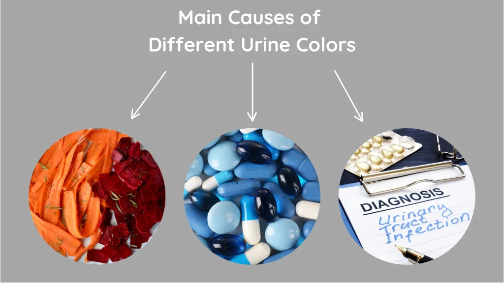 Kidney failure Causes