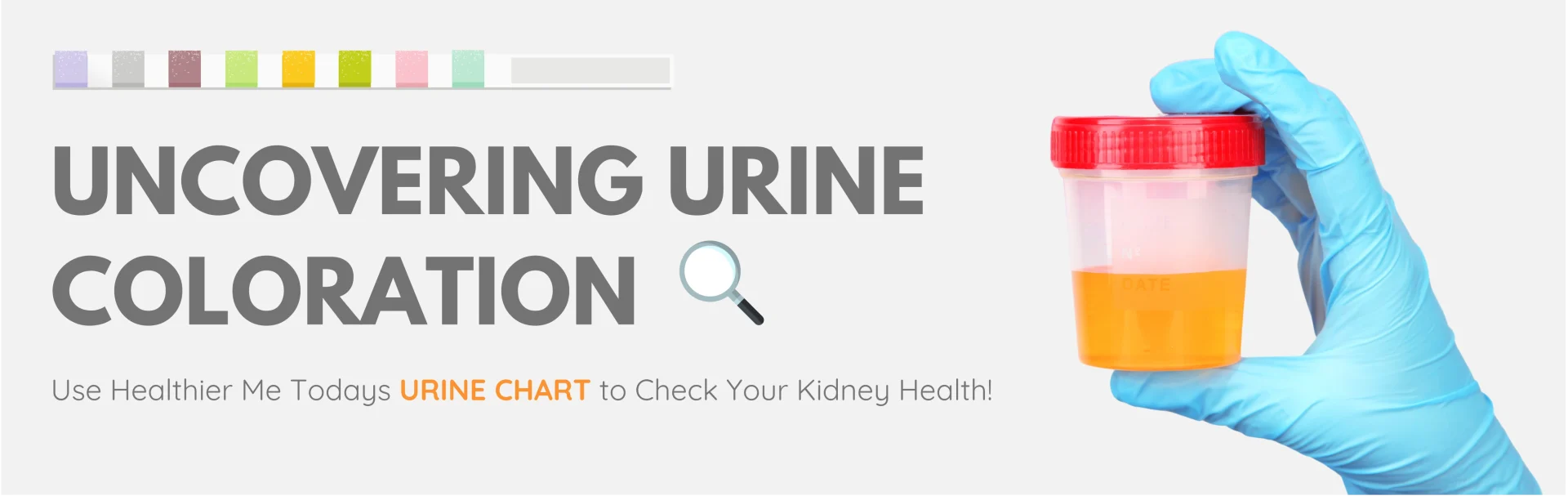 Kidney failure urine color chart