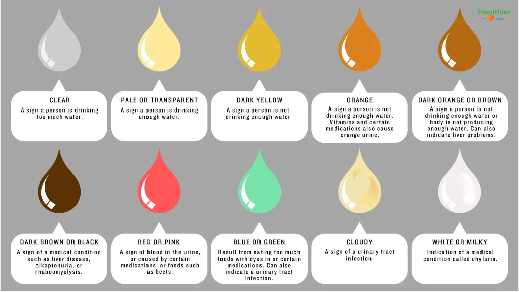 Kidney failure urine color chart