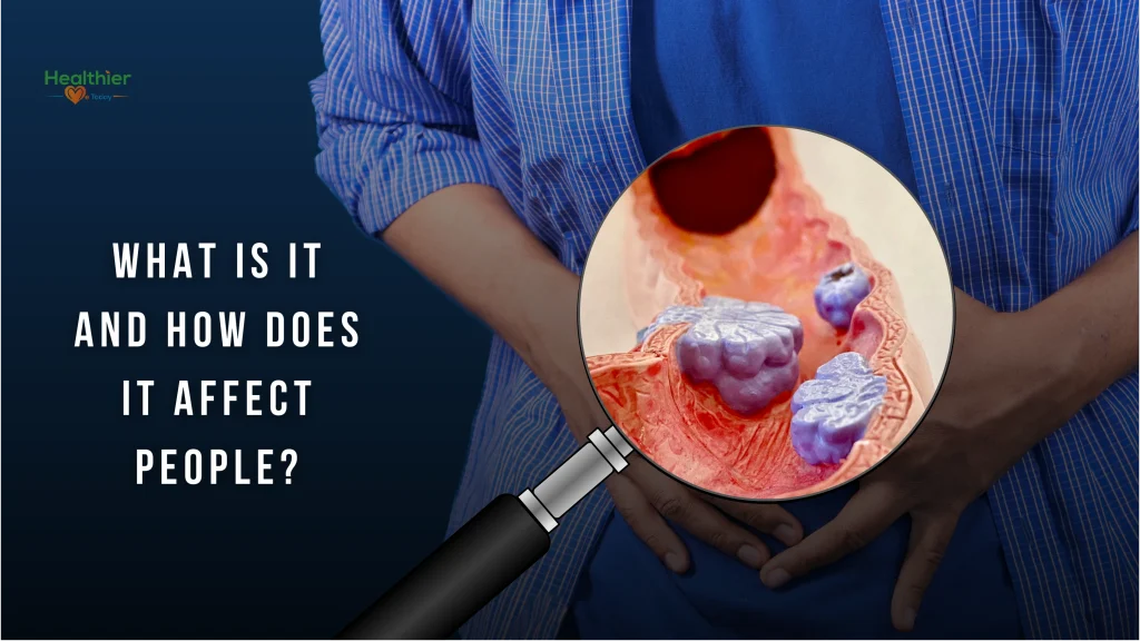 Colon cancer prevention