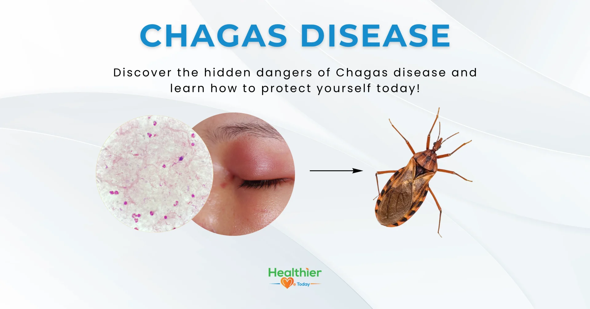 kissing bug