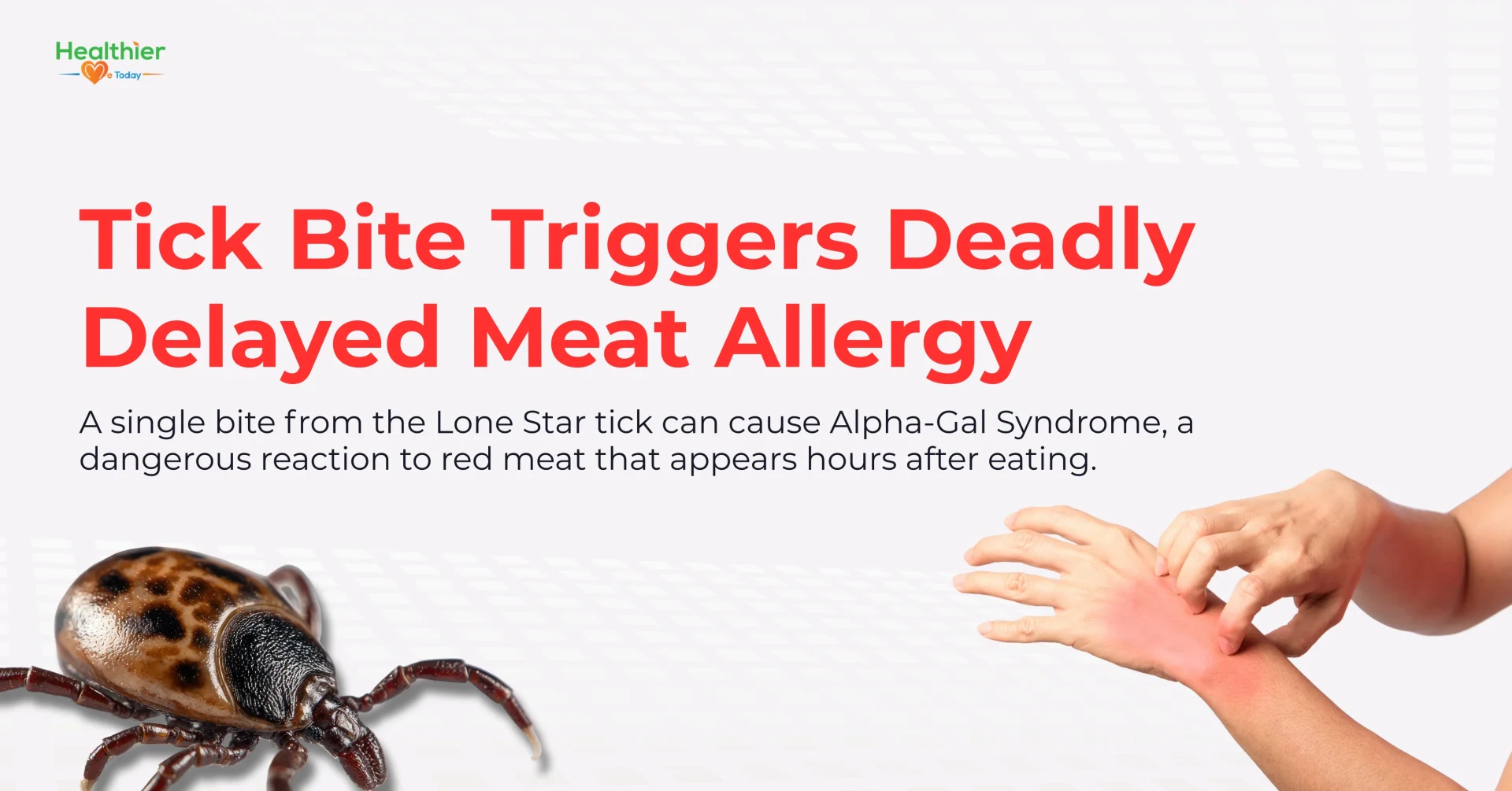 Tick related meat allergy death